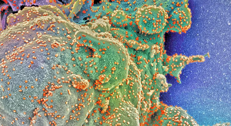 Grafika przedstawiająca ludzką komórkę atakowaną przez koronawirusa